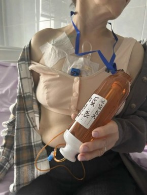 В Усинске онкопациенты получают жизненно важное лечение на месте