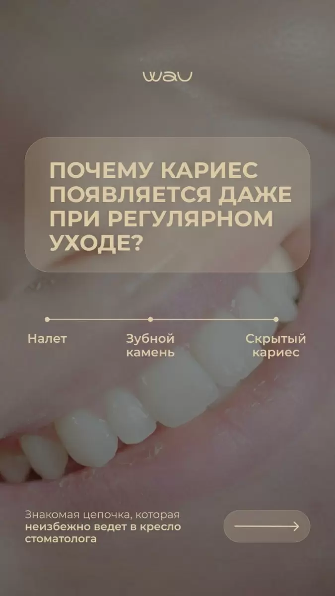 Как избавиться от зубного камня и кариеса: эффективные стратегии