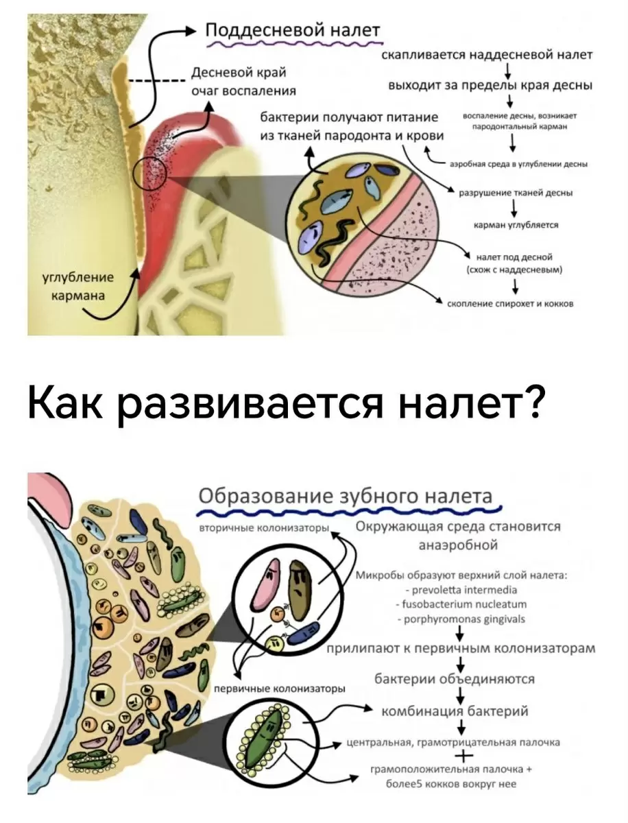 Почему налёт на зубах появляется с разной интенсивностью?